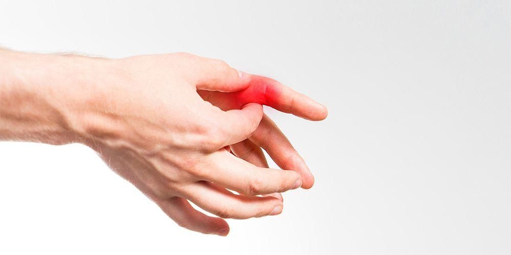 Типы травм пальцев и их причины, которых следует остерегаться при выполнении упражнений