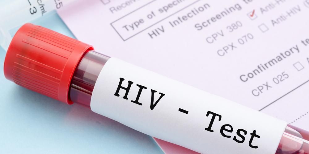 Faites attention aux points suivants si vous êtes condamné à être séropositif