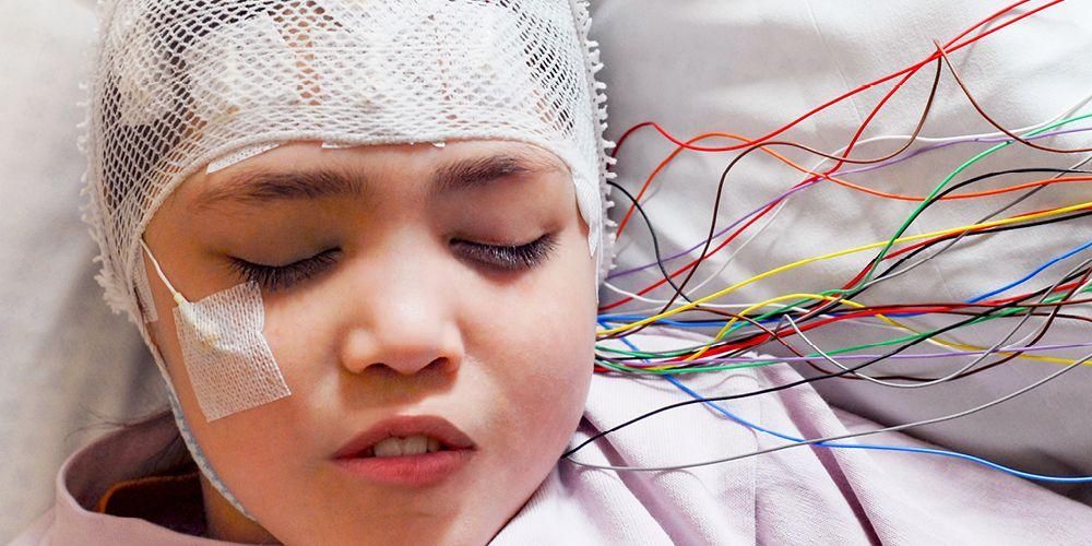 Quel est l'effet de l'épilepsie sur le développement de l'enfant?