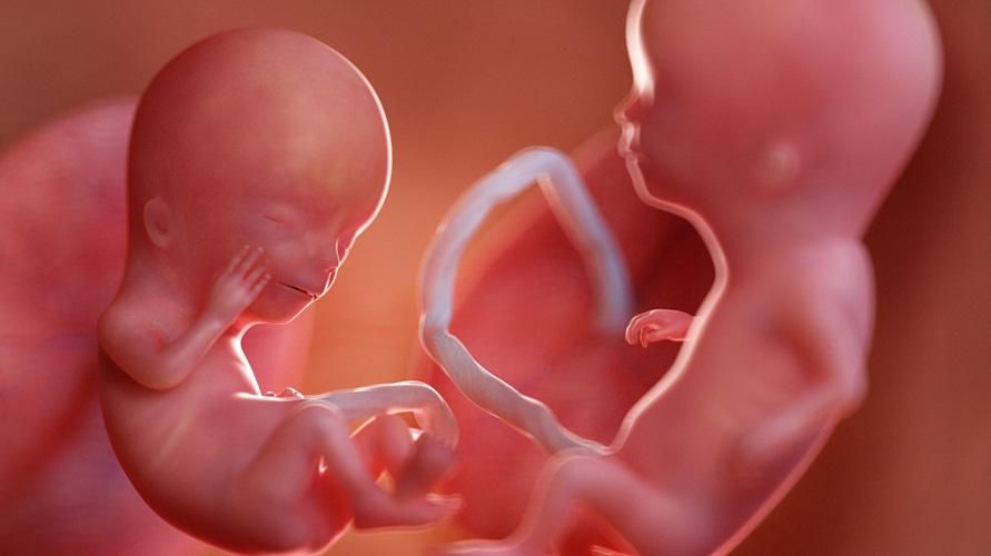 각 삼분기에 쌍둥이 태아의 징후와 발달 인식하기