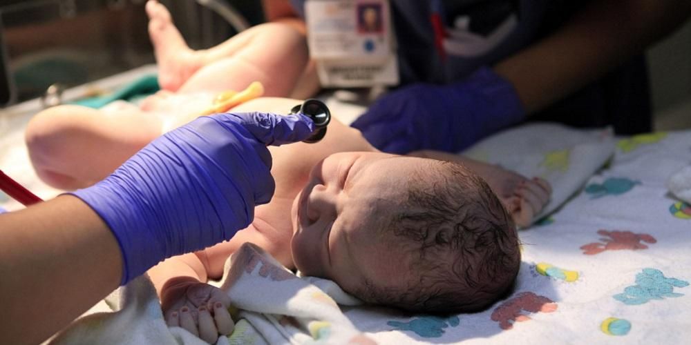 Макросомія – небезпечний стан для новонароджених, чому?