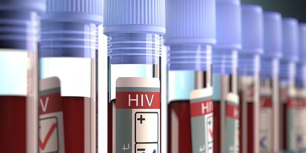 HIV AIDS: HIV 바이러스 알기