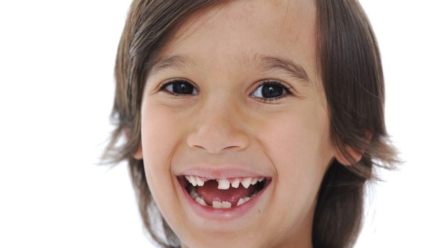 Čuvajte se hipodoncije ako vam zubi još uvijek ne rastu