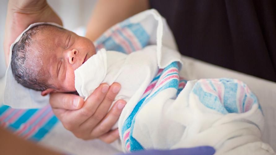 Détecté depuis le nouveau-né, qu'est-ce que la phocomélie chez les bébés ?